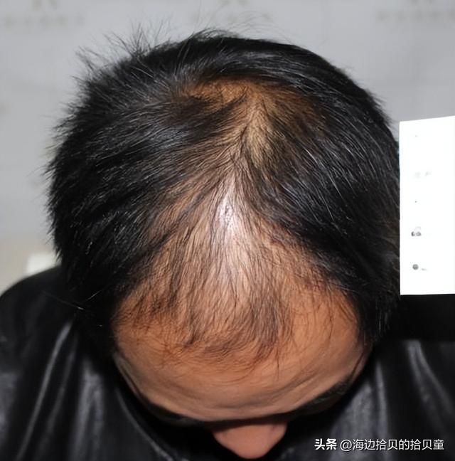 个牌子最好？育发液什么牌子最有效果？pg电子免费模拟器游戏日