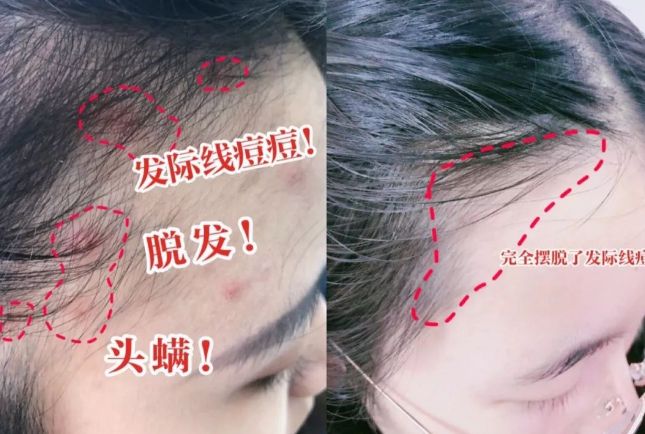 好？10分钟轻松养成女明星「绸缎发」pg电子中国洗完头自然风干还是吹干(图2)