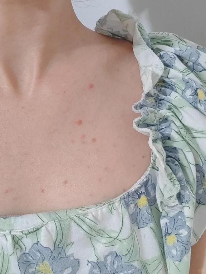 上架的同款毛巾！我们低价搞到了pg电子免费试玩模拟器胖某来刚(图2)